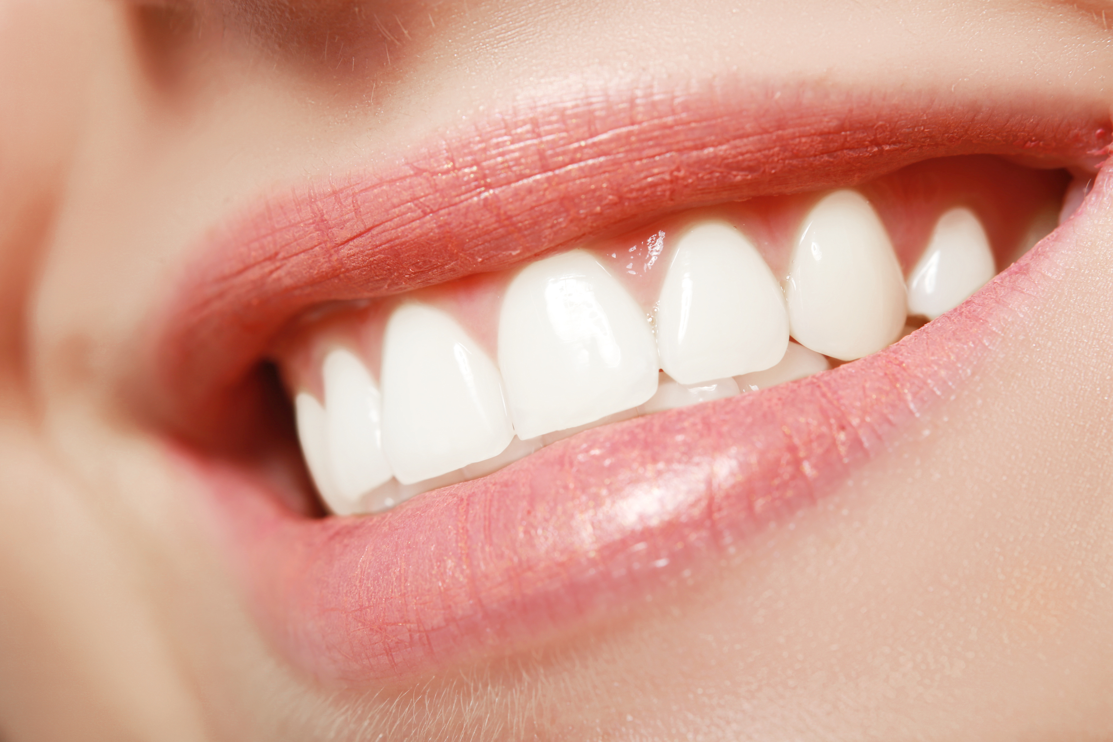A finished orthodontic result at NRH Orthodontics in North Richland Hills, TX