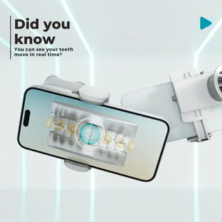 DentalMonitoring Scanbox Pro